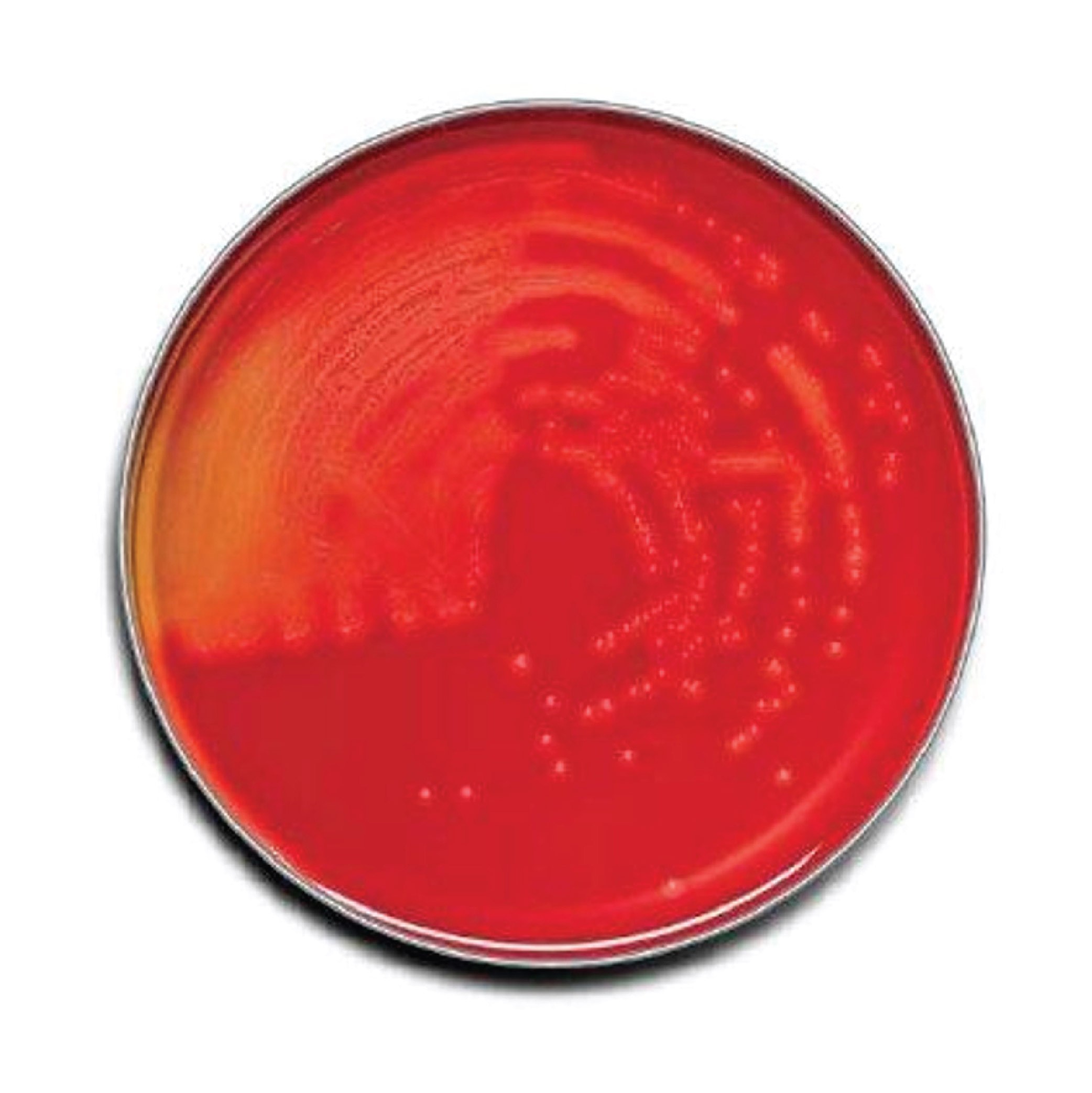 BD BBL™ Prepared Plated Media: Trypticase™ Soy Agar with 5% Sheep Blood(TSA II™)