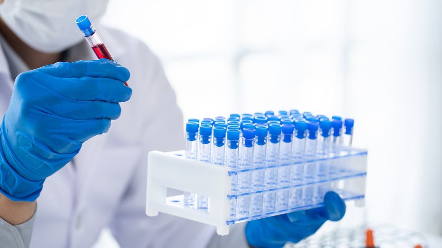 Sampling and Handling